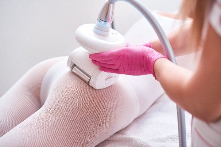 Głowica lasera diodowego podczas depilacji laserowej w centrum CosmetDerm