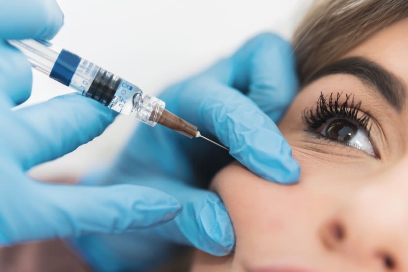 Mikroiniekcje Nanosoft Booster w okolicy oka, technika mikroigłowa, centrum CosmetDerm we Wrocławiu